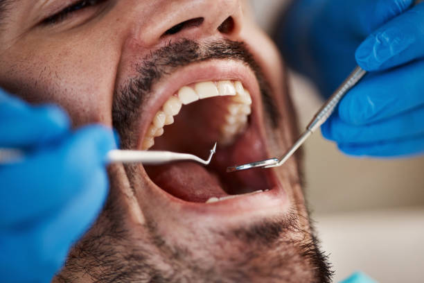 Best Emergency Treatment for Dental Infections or Abscesses in Lakefield, MN